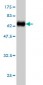 ADRM1 Antibody (monoclonal) (M01)